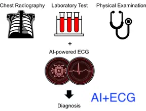 AI functioning ECG classification